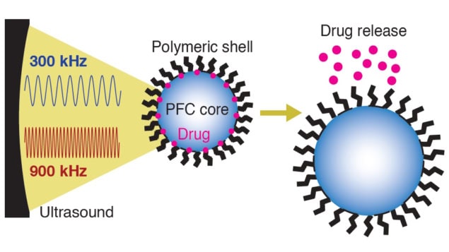 Nanocarriers release encapsulated drugs upon exposure to ultrasound Nanocarriers release encapsulated drugs upon exposure to ultrasound